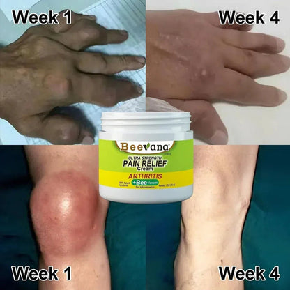 Bee Venom Ultra Strength Pain Relief Cream | Buy One Get One Free