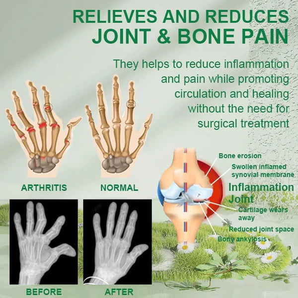 Bee Venom Joint and Bone Therapy Cream | Buy One Get 2 Free